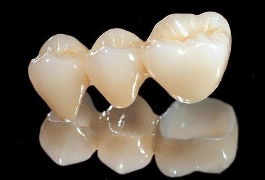 Tutta la corona dentaria di biossido di zirconio ceramico