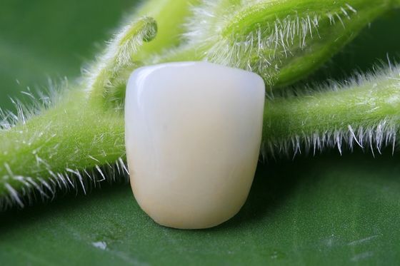 Corona dentaria biocompatibile ceramica piena di grande forma fisica EMAX