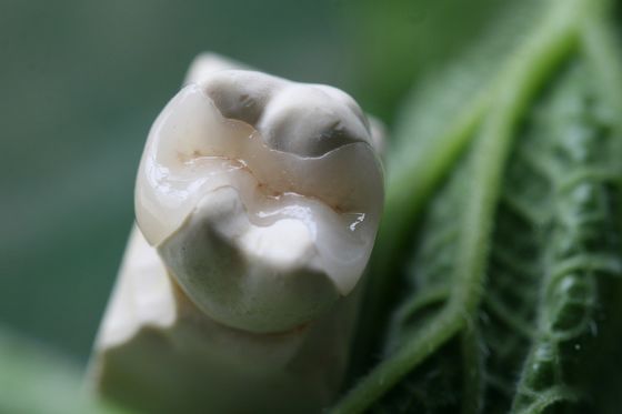 Naturale guardare tutta la porcellana impiallaccia la corona dentaria di EMAX