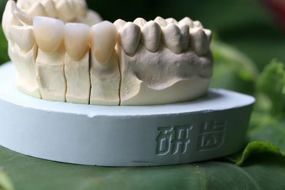 Denti di zircone della porcellana
