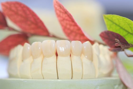 Il laboratorio dentario ha riparato la protesi ha messo a strati la corona dentaria di biossido di zirconio per Front Teeth