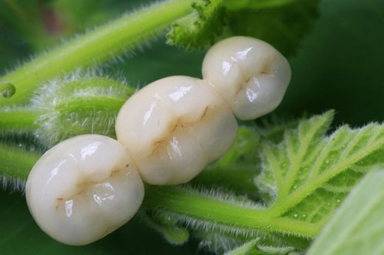 Tutta la corona dentaria di biossido di zirconio ceramico