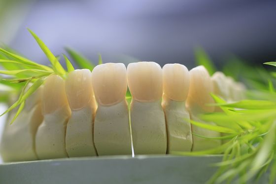 Il laboratorio dentario ha riparato la protesi ha messo a strati la corona dentaria di biossido di zirconio per Front Teeth