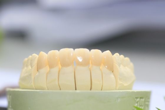 Corona dentaria di grande di biocompatibilità biossido di zirconio pieno di contorno per il laboratorio dentario