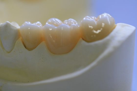 Il laboratorio dentario ha riparato la protesi ha messo a strati la corona dentaria di biossido di zirconio per Front Teeth