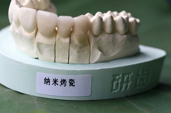 ISO13485 buona corona dentaria non preziosa di biocompatibilità PFM