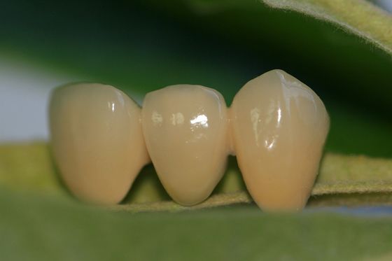 Corona dentaria di progettazione di biossido di zirconio ceramico pieno dentario ISO13485 del laboratorio per i denti anteriori