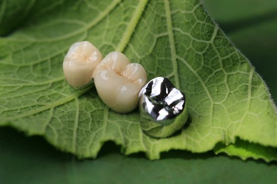 Corona dentaria della struttura PFM del metallo