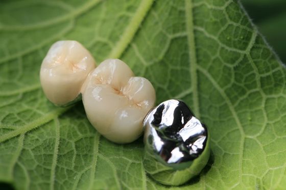 Corona dentaria della struttura PFM del metallo