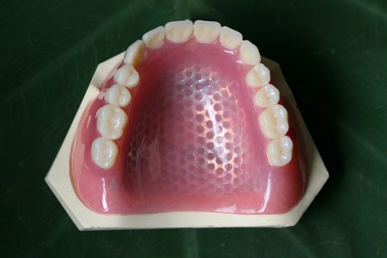 3D che stampa la struttura parziale del metallo della protesi dentaria dello scheletro del metallo