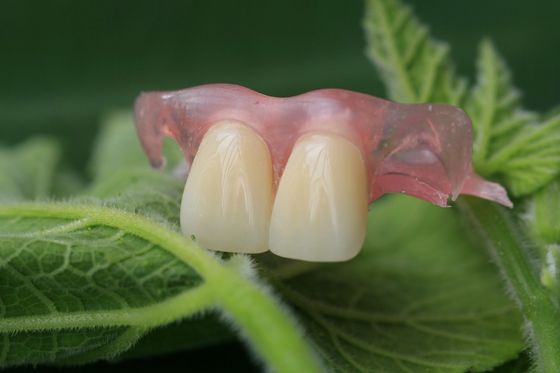 Protesi dentaria invisibile flessibile