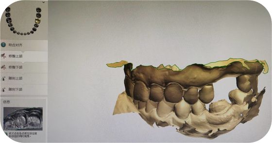 Impressione di cad Digital degli archivi orali di esame STL