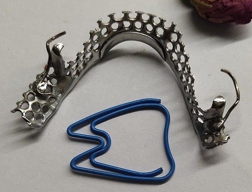 Struttura parziale del metallo della protesi dentaria dell'arco mandibolare di Casted