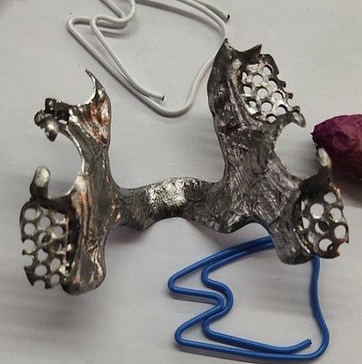 Struttura parziale del metallo della protesi dentaria dell'arco mandibolare di Casted