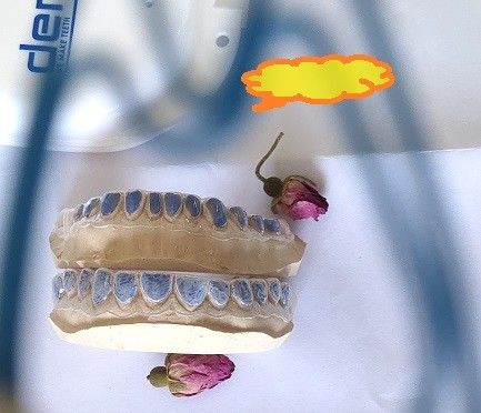 ISO13485 candeggio su ordinazione Tray For Whitening Teeth