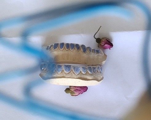 Dente cosmetico della stagnola di Trushine Thermoforming che imbianca vassoio