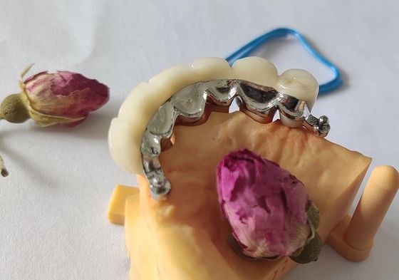 Corona dentaria della struttura PFM del metallo