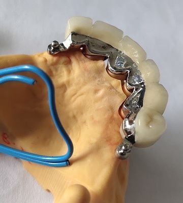 Buona corona dentaria metal-ceramica di forma fisica PFM