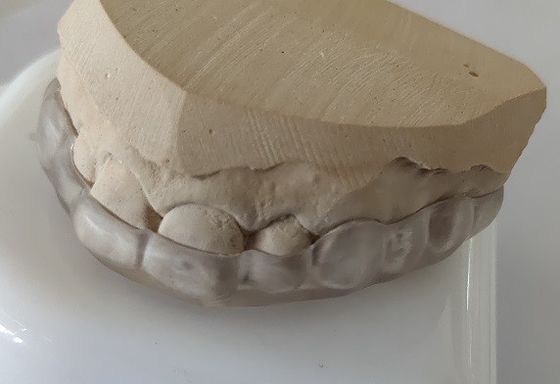 L'estetica abbassa il boccaglio dell'arco per il serraggio di denti