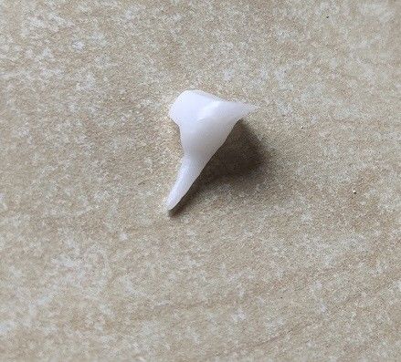 Rinforzando la porcellana Pin Core dentario di EMAX