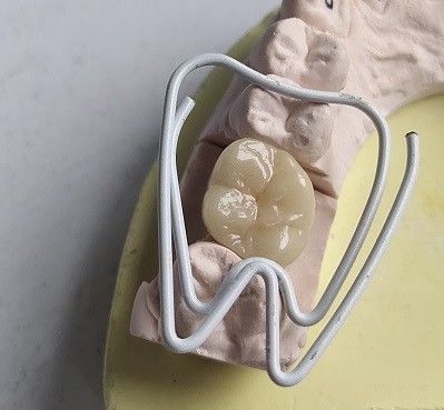 Denti di zircone della porcellana