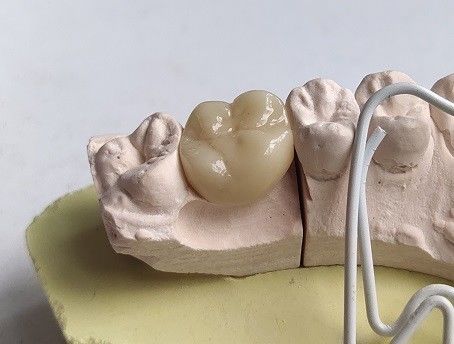 Denti di zircone della porcellana