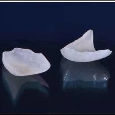 Naturale guardare tutta la porcellana impiallaccia la corona dentaria di EMAX