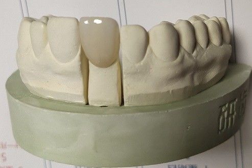 Il biossido di zirconio blocca la stampa dentaria 3D da fresatura di camma di cad