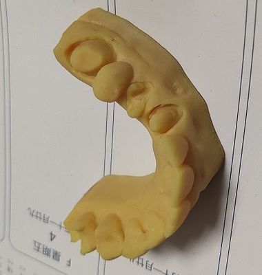 Modello dentario della stampa 3D di alta precisione ISO13485 Trushine