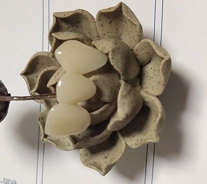 Il metallo ha basato la corona temporanea ibrida composita di PMMA