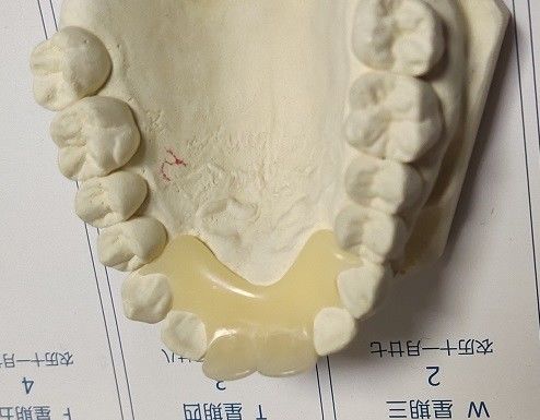 Protesi dentaria invisibile di nylon elastica molle di Trushine