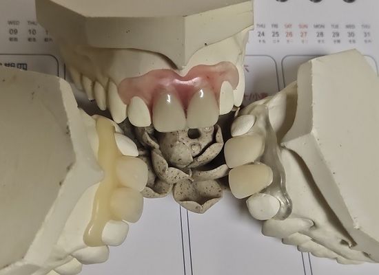 Protesi dentaria invisibile molle comoda di misura ISO13485 RPD
