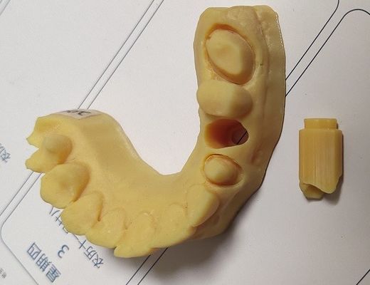 Modello dentario della stampa 3D di alta precisione ISO13485 Trushine