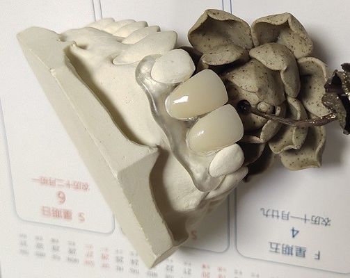 Protesi dentaria invisibile di nylon elastica molle di Trushine