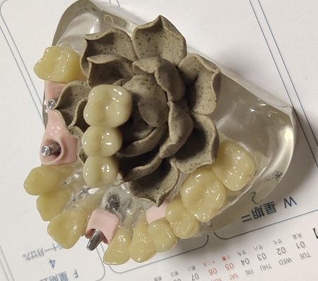 100 corona provvisoria di biocompatibilità PMMA di per cento