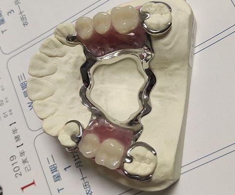 Struttura parziale del metallo della protesi dentaria dell'arco di Co della lega mascellare del Cr