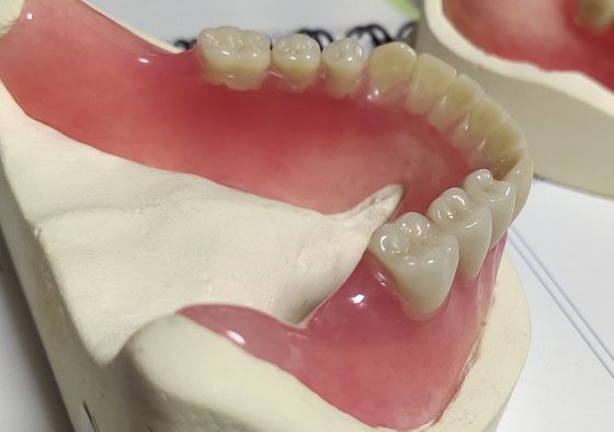 Protesi dentaria parziale acrilica curata fredda della protesi dentaria piena di estetica