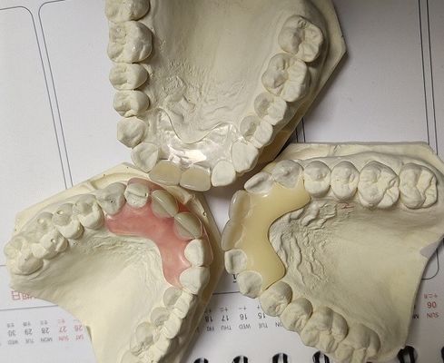Protesi dentaria invisibile molle ed elastica temporanea di Valplast