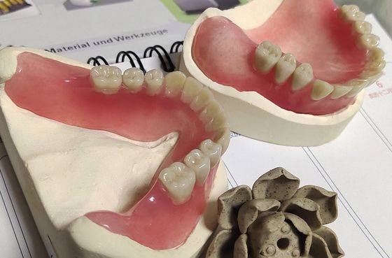Protesi dentaria parziale acrilica dell'arco pieno