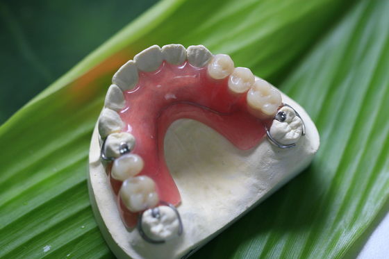 Protesi dentaria invisibile flessibile parziale per i denti anteriori