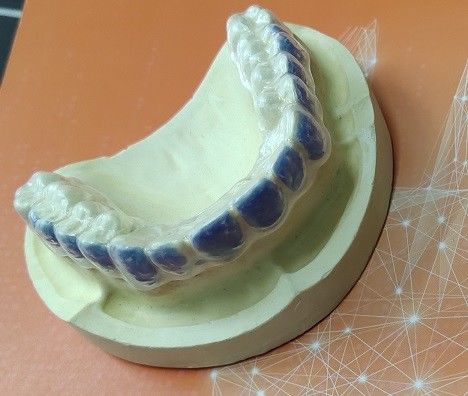 Denti ISO13485 che imbiancano la guardia For Smoke Stains del candeggiante
