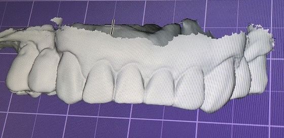 derisione di 3D Digital sui denti altri prodotti dentari