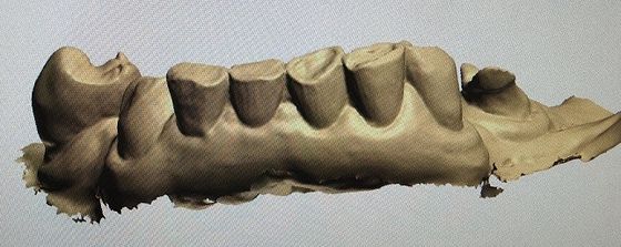 derisione di 3D Digital sui denti altri prodotti dentari