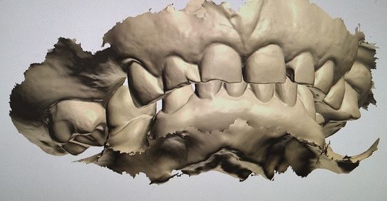 Denti del modello del visualizzatore digitale di progettazione di camma di cad altri prodotti dentari