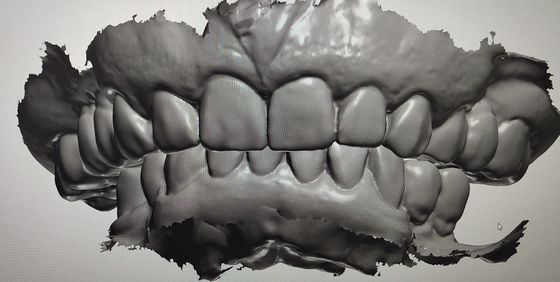 Denti del modello del visualizzatore digitale di progettazione di camma di cad altri prodotti dentari