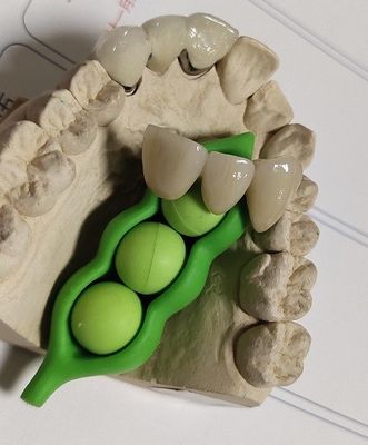 Stampa dentaria 3D di progettazione di camma di cad