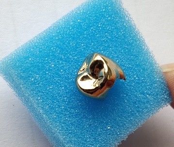Corona dentaria dell'alto metallo pieno nobile dell'oro