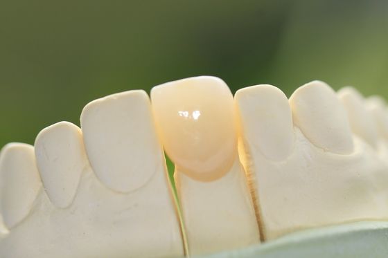 Corona dentaria ceramica di vetro permanente naturale per i denti anteriori