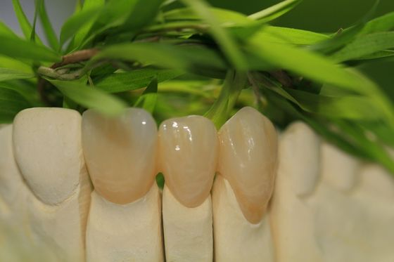 Le stelle piene della corona 5 dell'ossido di zirconio dell'odontoiatria prostetica progettano il laboratorio dentario
