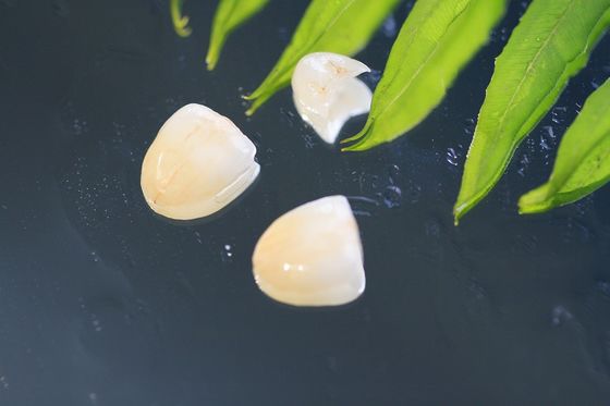 Corona dentaria naturale di EMAX